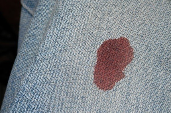 Пятна крови на одежде