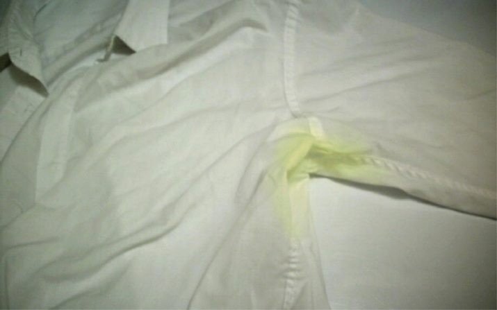 Маленькие жёлтые пятна на белой одежде